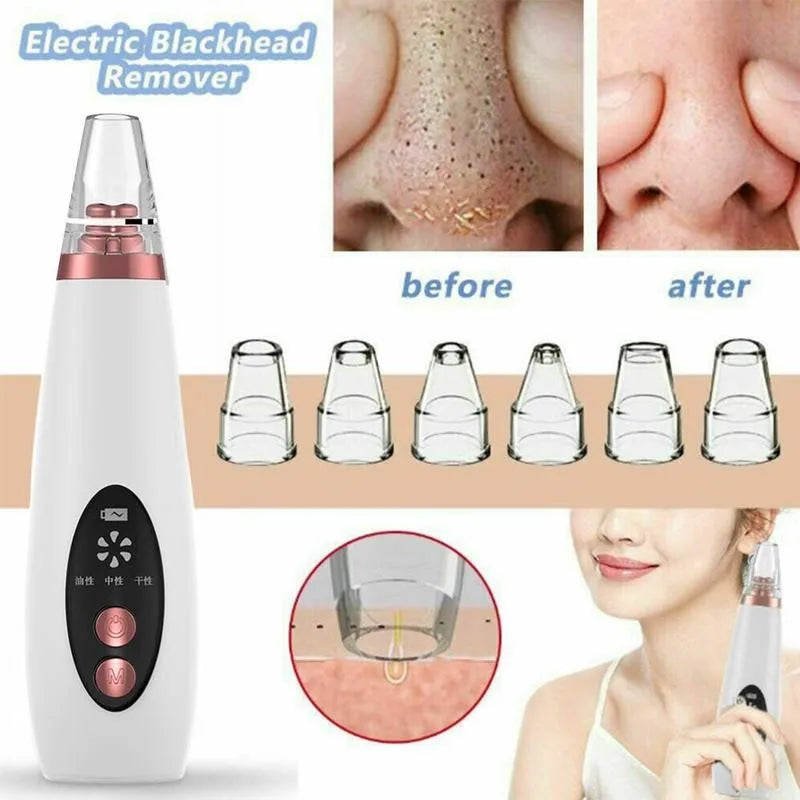Blackhead Black Dot Remover Face Pore Vacuum Skin Care Acne Pore Cleaner Pimple Removal Vacuum Suction Tools USB Charger